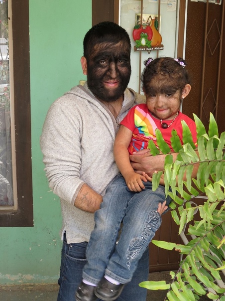 Самая волосатая семья в мире Знакомьтесь, это 38-летний мексиканец Чуи и его родственники. Все они страдают редким заболеванием — врожденным гипертрихозом, то есть избыточной волосатостью на
