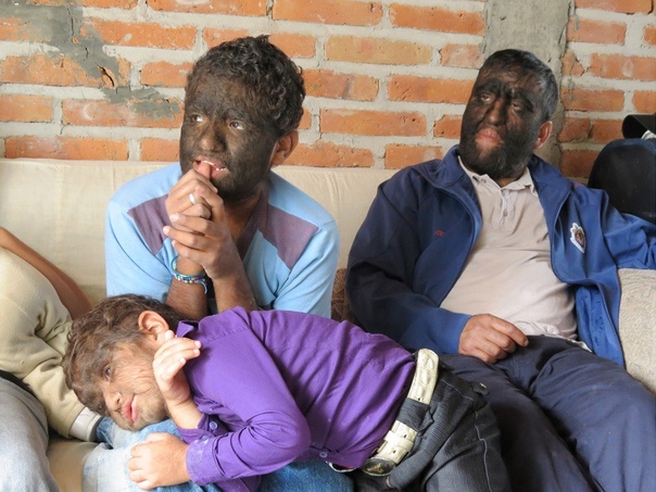 Самая волосатая семья в мире Знакомьтесь, это 38-летний мексиканец Чуи и его родственники. Все они страдают редким заболеванием — врожденным гипертрихозом, то есть избыточной волосатостью на